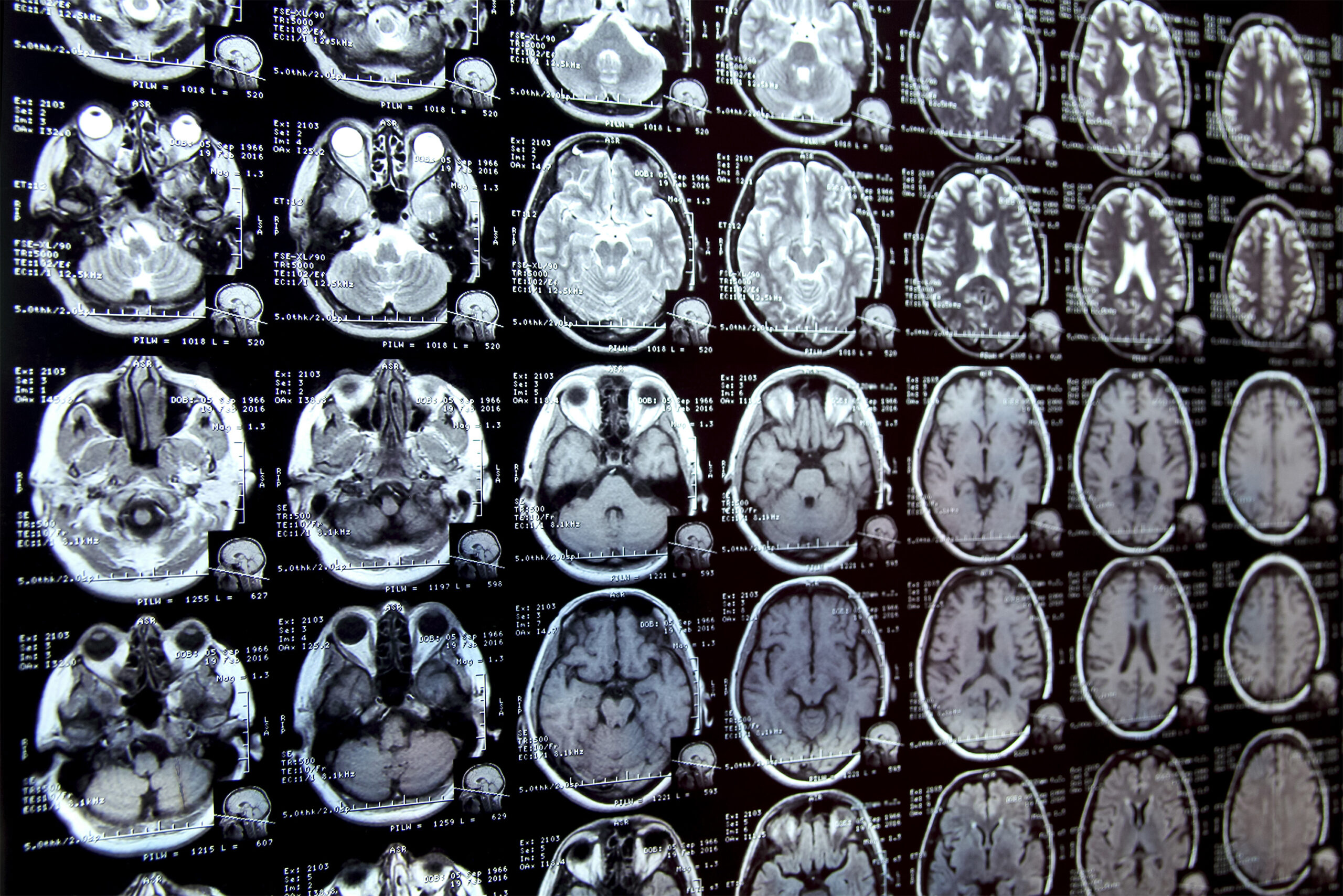 New AI system could accelerate clinical research | MIT News | Massachusetts Institute of Technology